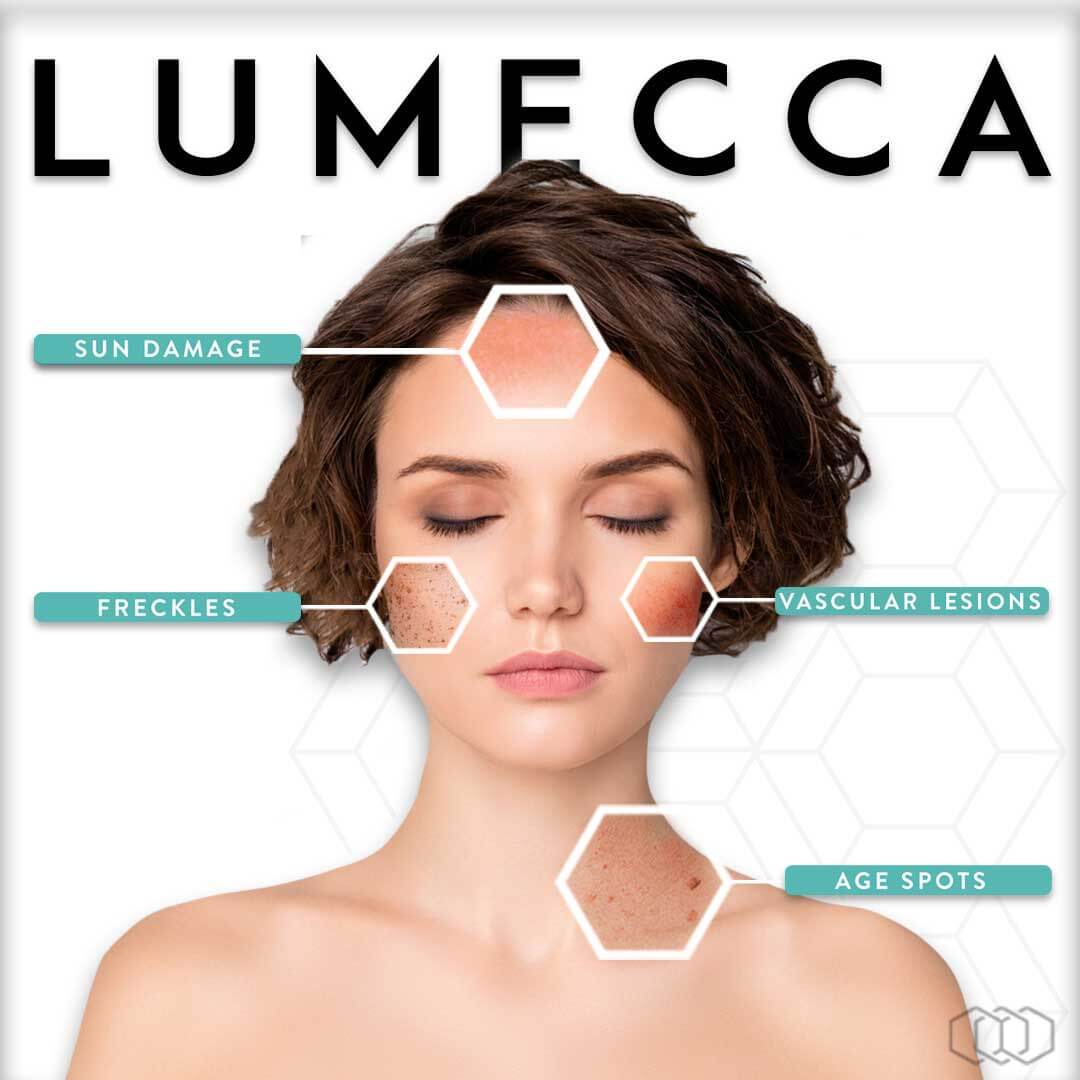 lumecca-infographic-instagram-post-brown-hair-preview-1 (1)