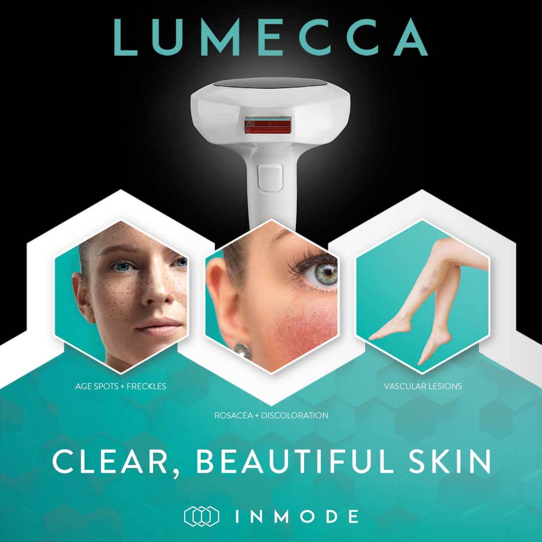 lumecca-treatment-area-instagram-post-preview-1 (1)